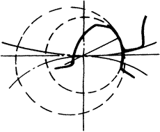 �X݆�����g(sh��)�Z�A���X݆�͈A���X݆��