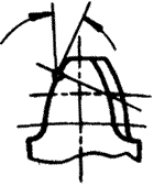 �X݆�����g(sh��)�Z�A���X݆�͈A���X݆��